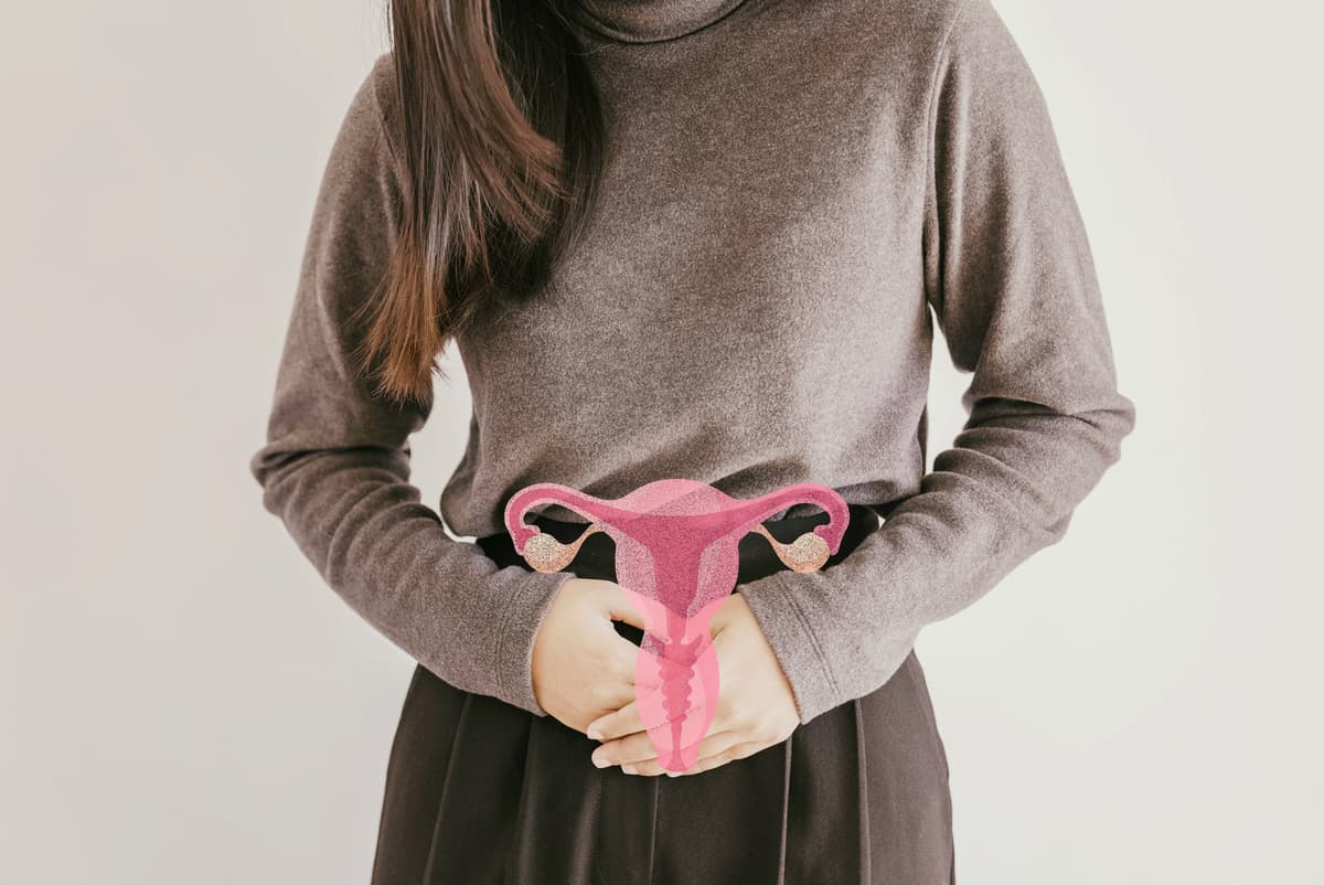 PCOS (Polycystic Ovary Syndrome): What You Need to Know