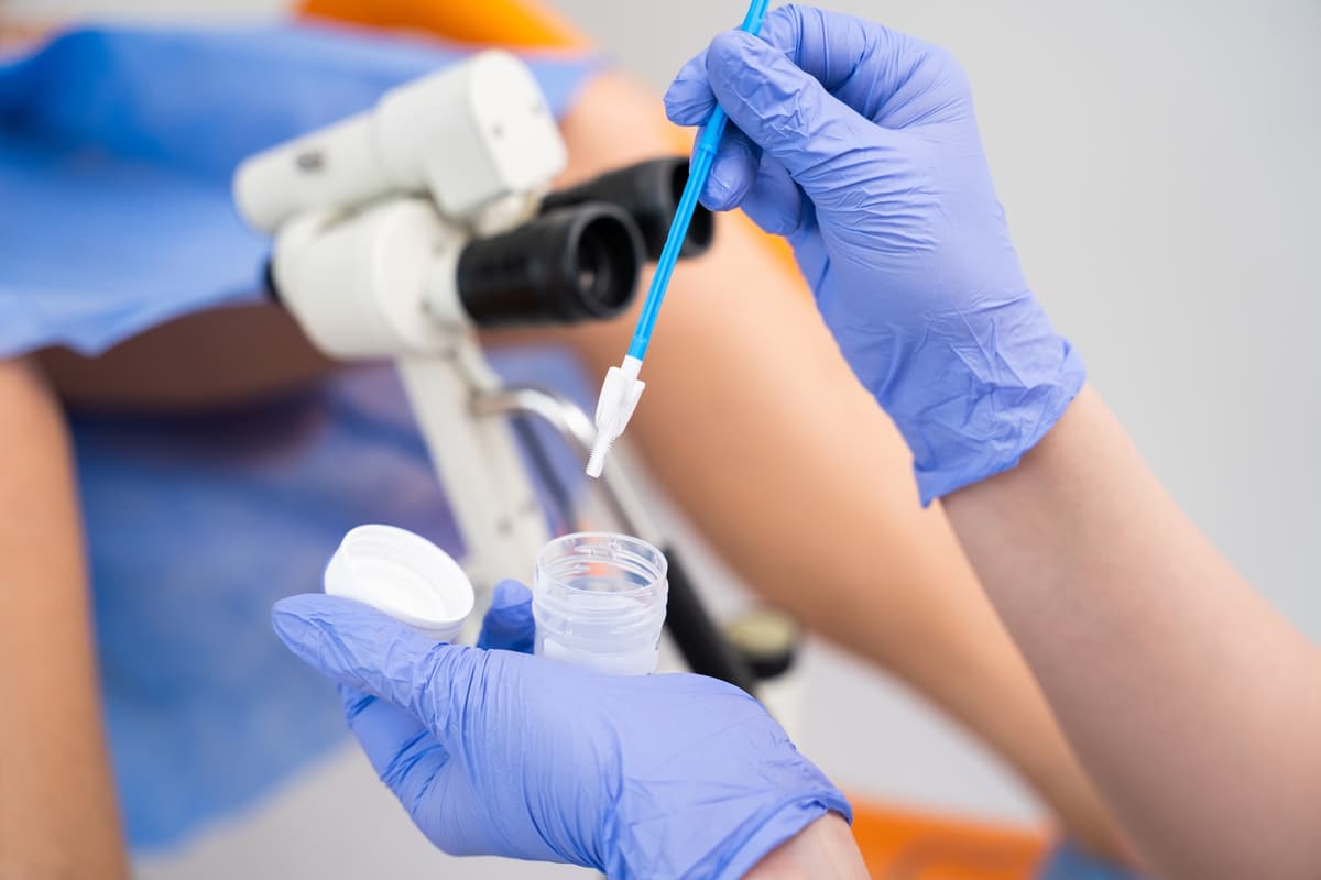 HPV and the Cervical Cancer Connection