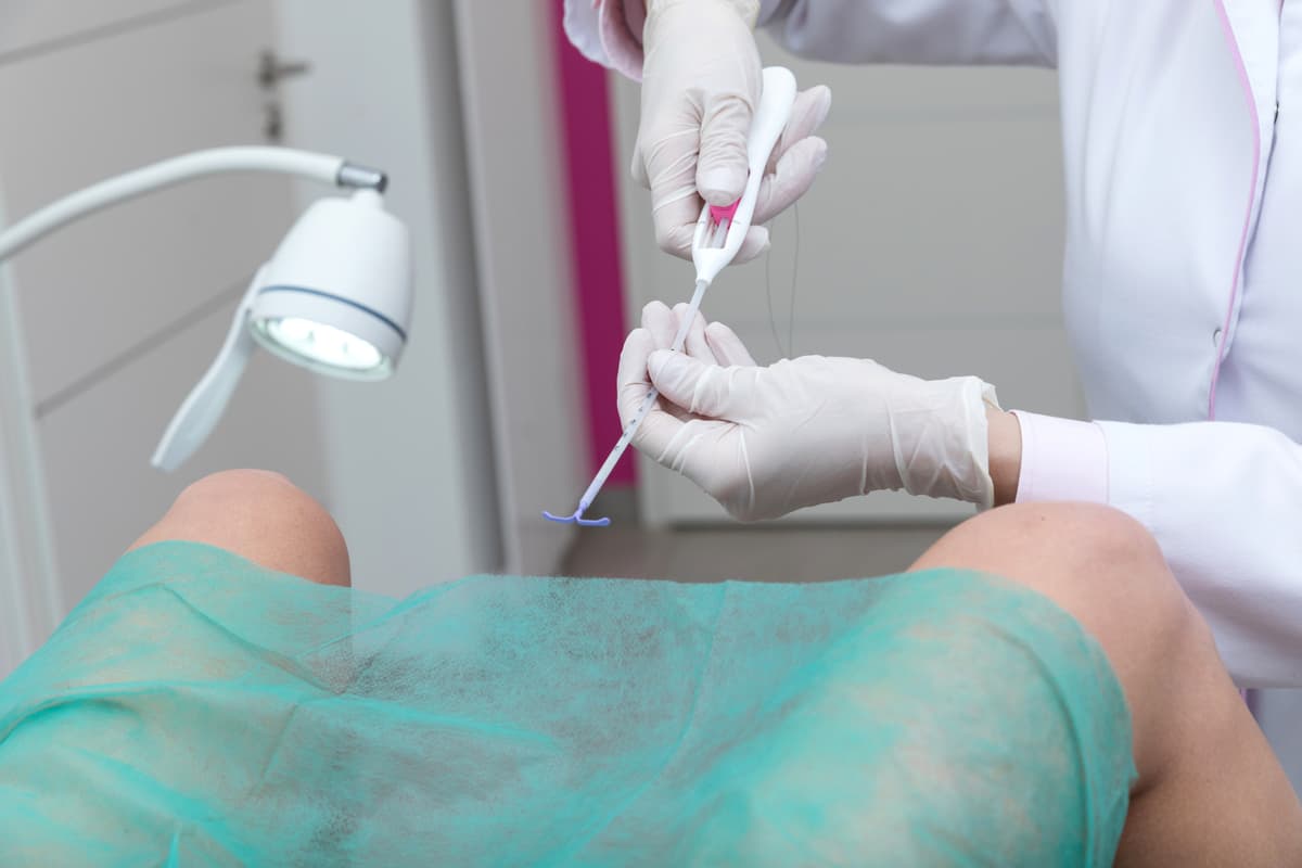 IUD Insertion and Removal: What to Know